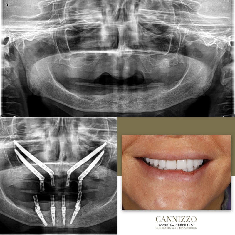 Sedazione nei trattamenti dentistici